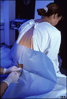 epidurala