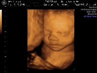 4d-scan-1 Ecografie 4d - Saptamana 27