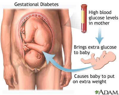 Diabetul in timpul sarcinii