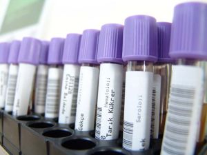 Analiza biochimica a sangelui