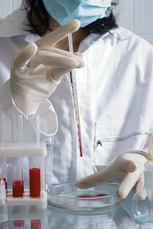 Dry Test – detectarea anomaliilor cromozomiale si ale defectelor de tub neural