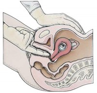 examinare-pelvina-1
