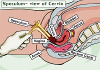 examinare-pelvina-cu-speculum