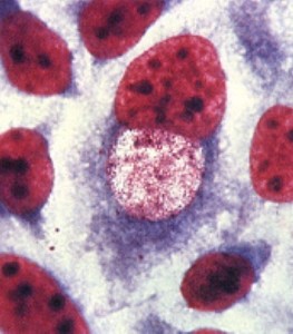 Testarea pentru Chlamydia