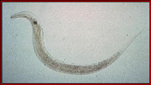 Oxiurii – paraziti intestinali