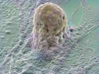 celula-stem-amplificata-prin-micrografie-electronica-fotografie-la-microscop