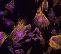 celule-stem-mezenchimale