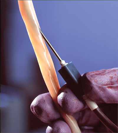 Recoltarea celulelor stem