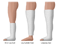 gipsul-lung