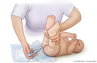 rectal