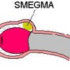 smegma